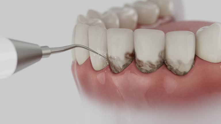 Reliable Dental contractor in Union, MS by Dentist Open Now